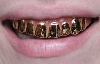 Золотовалютный запас Беларуси за июнь истощился на $9,5 млн