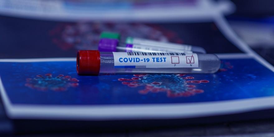 Белорусы получат 5000 бесплатных тестов на антитела к COVID-19